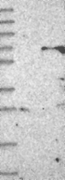 NBP1-81149 - ZNF426