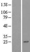 NBL1-18150 - ZNF428 Lysate