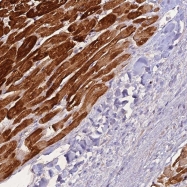 NBP1-82897 - ZNF436