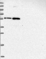 NBP1-82897 - ZNF436