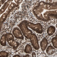 NBP1-81344 - ZNF44
