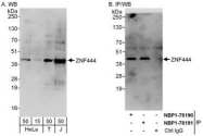 NBP1-78190 - ZNF444