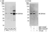 NBP1-78191 - ZNF444