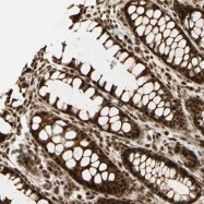 NBP1-80593 - ZNF446
