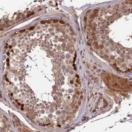 NBP1-92626 - ZNF467