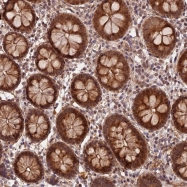NBP1-81124 - ZNF480