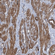 NBP1-81432 - ZNF490
