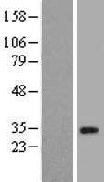 NBL1-18167 - ZNF501 Lysate