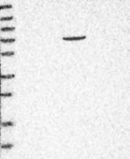 NBP1-82297 - ZNF502