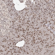 NBP1-81889 - ZNF503