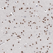 NBP1-92628 - ZNF509