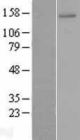 NBL1-18170 - ZNF521 Lysate