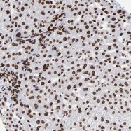 NBP1-89224 - ZNF544