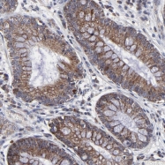 NBP1-86158 - ZNF550