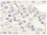 NB100-74657 - ZNF592