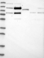 NBP1-86646 - ZNF592