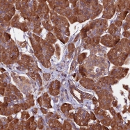 NBP1-84658 - ZNF598