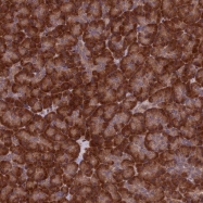 NBP1-84659 - ZNF598