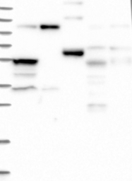NBP1-84658 - ZNF598