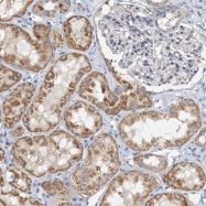 NBP1-92632 - ZNF606