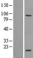 NBL1-18207 - ZNF606 Lysate