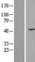 NBL1-18210 - ZNF621 Lysate