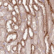 NBP1-92637 - ZNF623