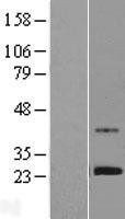 NBL1-18212 - ZNF625 Lysate