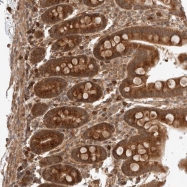 NBP1-82288 - ZNF649