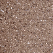 NBP1-86828 - ZNF653