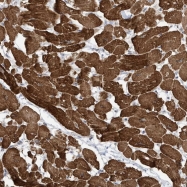 NBP1-83795 - ZNF654