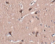 NBP1-77357 - ZNF667