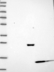 NBP1-92640 - ZNF669