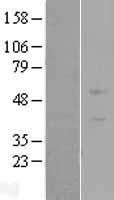 NBL1-18220 - ZNF669 Lysate