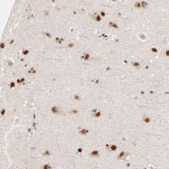 NBP1-81218 - ZNF670