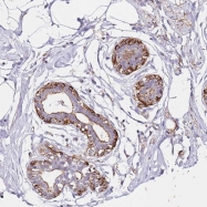 NBP1-92641 - ZNF671