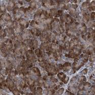 NBP1-82676 - ZNF677
