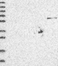NBP1-82677 - ZNF677