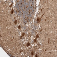 NBP1-80783 - ZNF695