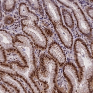 NBP1-92642 - ZNF707