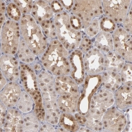 NBP1-82020 - ZNF75A