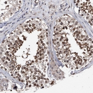 NBP1-85324 - ZNF76