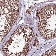 NBP1-92643 - ZNF766