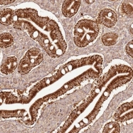 NBP1-92644 - ZNF776
