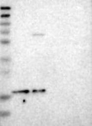NBP1-85673 - ZNHIT1