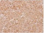 NBP1-33372 - ZNHIT1