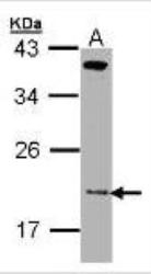 NBP1-33372 - ZNHIT1