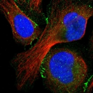 NBP1-85046 - ZO-1 / Tight junction protein 1