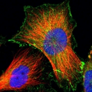 NBP1-85047 - ZO-1 / Tight junction protein 1