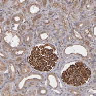 NBP1-85046 - ZO-1 / Tight junction protein 1